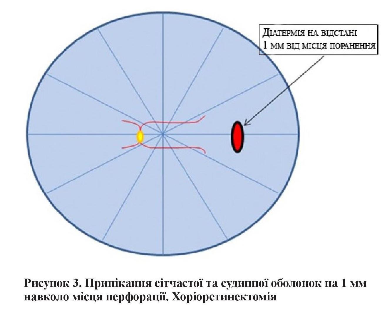 n8s4 fig 3