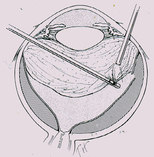 n8s6 fig 15b