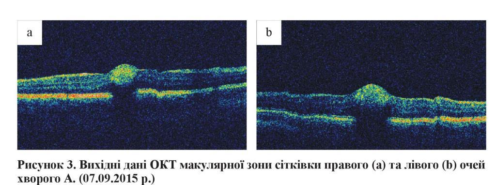 n05s11 fig4