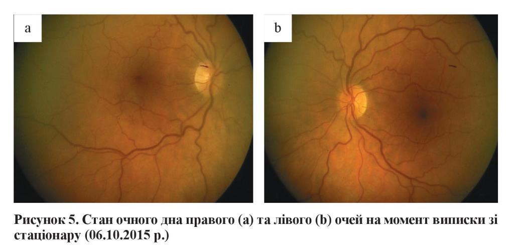 n05s11 fig6