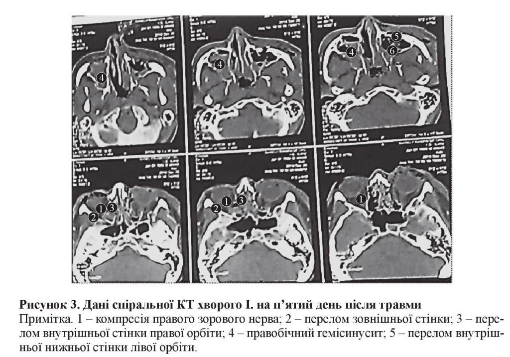 n05s6 fig5