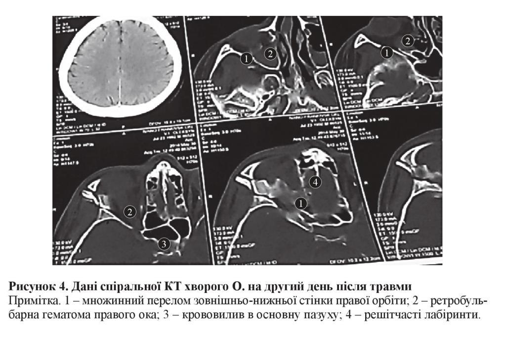 n05s6 fig6