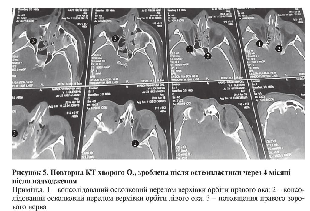 n05s6 fig7