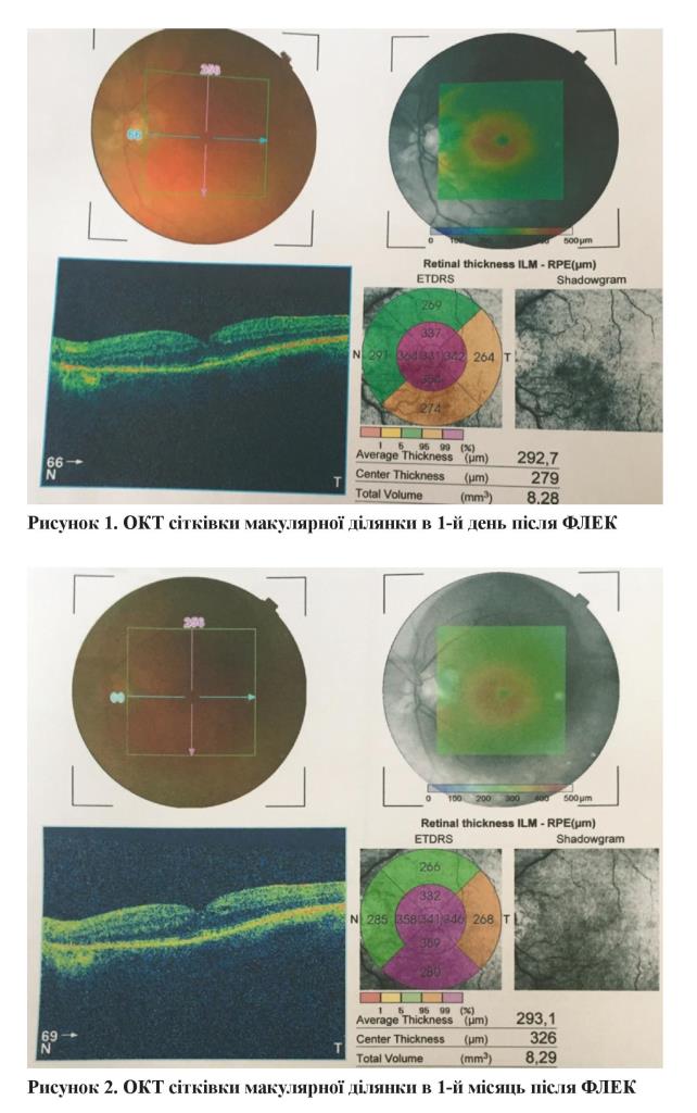 n05s9 fig2